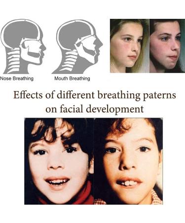 PoVwlty 120 PCS Mouth Tape for Sleeping Better | Drug-Free Nasal Strips to Reduce Snoring and Improve Sleep Quality - Buy Online on GoSupps.com