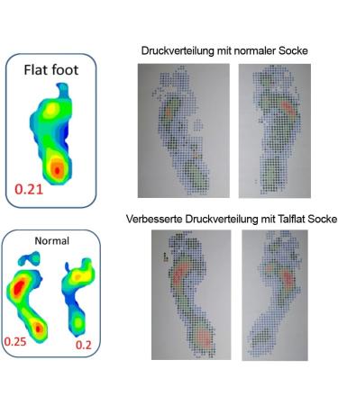 Inook Talflat Correction Socks for Foot Pain Relief - Flat Feet Fallen Arches & Hallux Valgus - kotex Certified Black - Buy Online on GoSupps.com
