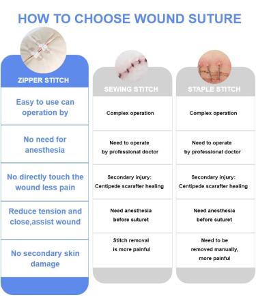 FDA Cleared Waterproof Adhesive Bandages for Emergency Wound Closure - 4 Pack - Buy Online on GoSupps.com