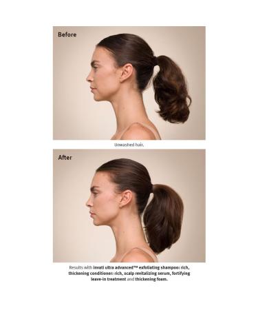Aveda Invati Ultra Advanced Scalp Revitalizing Serum 5 FL OZ - Best Scalp Care for Thinning Hair | International Shipping - Buy Online on GoSupps.com