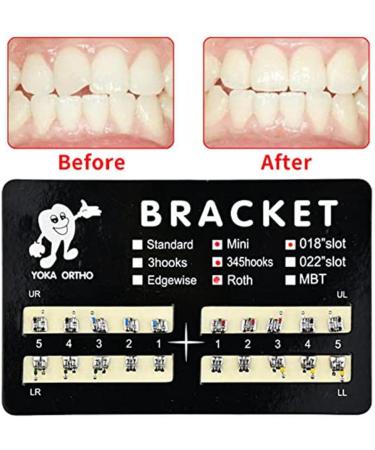 QWAMBVZE 10pcs Model Metal Brackets - 018 Slot 345 Hook Tooth Gem Kit for Braces | International Shipping - Buy Online on GoSupps.com