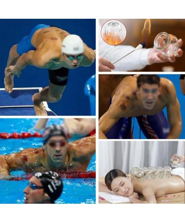 14 Piece Professional Cupping Therapy Set - Thick Glass Traditional Chinese Cupping Tools for Optimal Healing - Buy Online on GoSupps.com