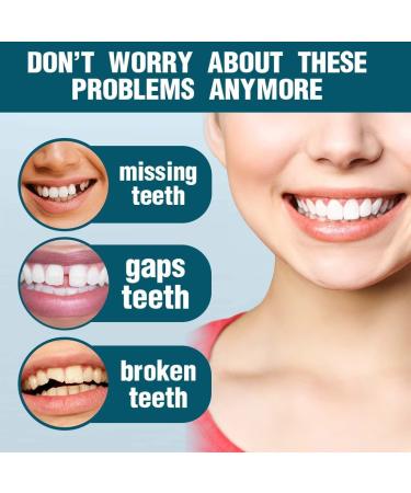 Eliav 2 Couples False Teeth Veneers - White Dentures for Top & Lower Jaw | Temporary Cosmetic Tooth Covers - Buy Online on GoSupps.com