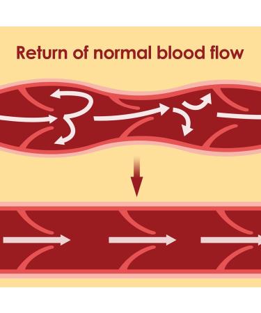 DIFICATO Varicose Vein Treatment Plaster | 12/24 Vein Health Patches for Legs | Effective Relief from Varicose Veins - Buy Online on GoSupps.com