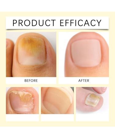 Stylo soin ongles stylo huile cuticules stylos soin ongles hydratants non collants nails pieds stylos huile cuticles portables croissance r sistance nails secs endommag s r paration rigide (4pcs) - Buy Online on GoSupps.com