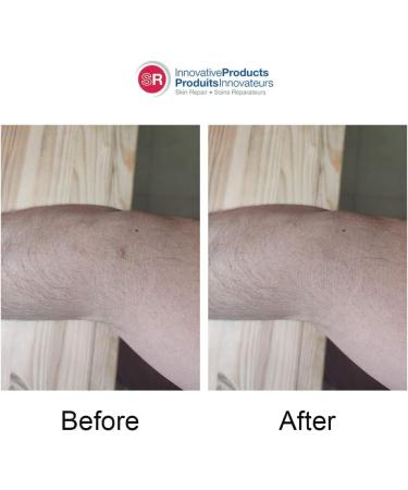 ScarFix 15ml: Skin Repair Solution & Scar Treatment Cream - Buy Online on GoSupps.com