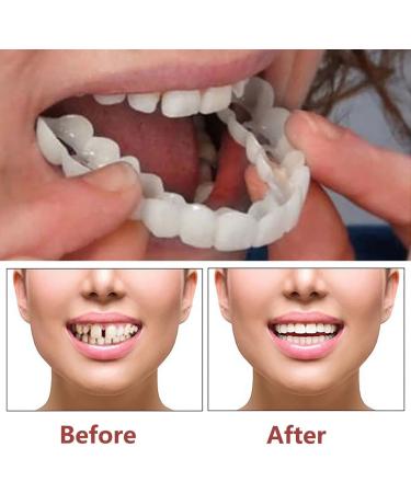 Fluktrix Instant Veneer Sponsors - Brightening Cosmetic Cover for Artificial Teeth | Temporarily Snap-On Veneers for Upper & Lower Smile - Buy Online on GoSupps.com