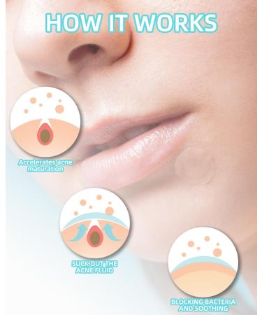 360 Pcs Hydrocolloid Pimple Patches - Invisible & Natural with Tea Tree Oil for Quick Healing of Acne & Breakouts - Buy Online on GoSupps.com