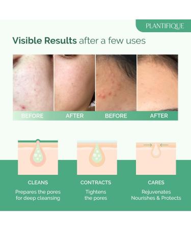 PLANTIFIQUE Korean Vitamin C Face Massage Serum and Korean Skin Care Detox Face Mask with Avocado & Superfoods - Buy Online on GoSupps.com