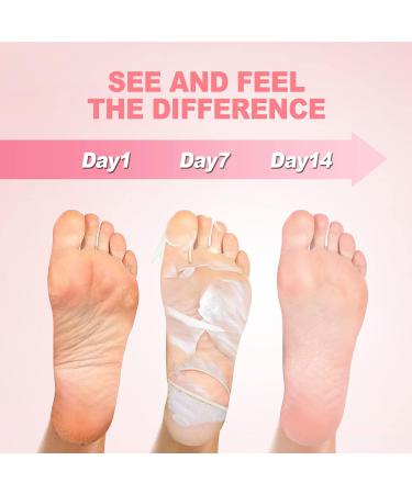 Foot Peel Mask 3 Pack JVR Lactic Acid Foot Mask Foot Exfoliating Socks Foot Care for Callus Remove Repair Cracked Heel & Dead Dry & Hard Skin Baby Soft Smooth Touch Feet (Rose) - Buy Online on GoSupps.com