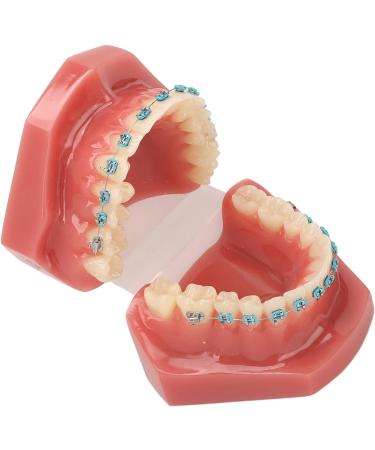 Orthodontic Model | 28 Partial Dental Resin Demonstration & Bracket Model for International Shipping - Buy Online on GoSupps.com
