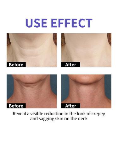 Neck Firming Cream | Anti-Aging Solution for Tightening & Lifting Sagging Skin | Hydrating Formula to Reduce Fine Lines & Wrinkles - Buy Online on GoSupps.com