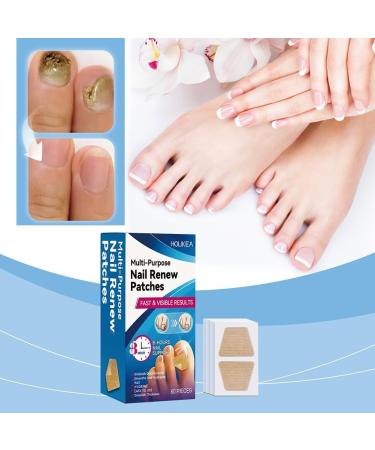 Lot de 60 patchs de r paration des ongles autocollants de correction des ongles anti-infection autocollants de soin des ongles en tissu non tiss pour le soin des ongles des orteils - Buy Online on GoSupps.com