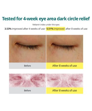 GOODAL Green Tangerine Vitamin C Eye Cream - Dark Circle Relief Anti-Aging & Elasticity Treatment (1.01oz) - International Shipping Available - Buy Online on GoSupps.com