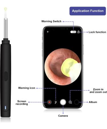 NANANARDOSO Wireless Ear Wax Removal Camera with 1080P HD Endoscope Otoscope - 6 LED Lights, 6 Ear Spoons, Compatible with iPhone, iPad, Android Phones - Buy Online on GoSupps.com