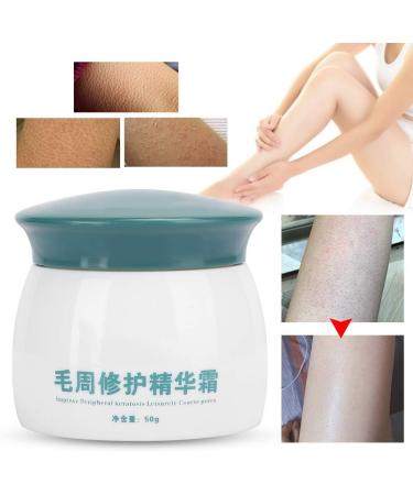  GAESHOW Keratosis Pilaris Cream Exfoliating Body Scrub 50g Soothing Keratosis Pilaris Body Cream for Treating Pimples and Sensitive Skin - Buy Online on GoSupps.com