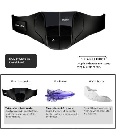 KOHEEL MGM Straightener for Adults for a Confident Smile (1 Pack) - Buy Online on GoSupps.com