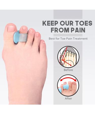 MHSY Toe Separators - 4PCS Gel Bunion Correctors & Toe Spacers for Overlapping Toes, Hallux Valgus Relief - Blue - Buy Online on GoSupps.com