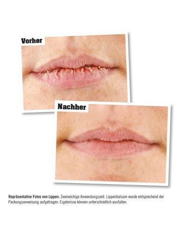 O'Keeffe's Lip Repair Cooling Lip Balm 4.2g - Hydrating & Soothing Lip Care for Dry Lips - International Shipping Available - Buy Online on GoSupps.com