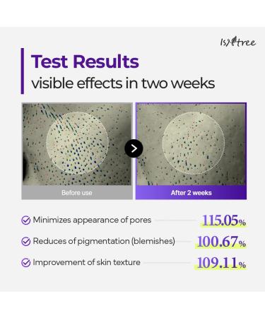 ISNTREE Onion Newpair Booster 2000s 1.69 fl.oz | Spicule Microneedling Facial Serum | Panthenol Hyaluronic Acid Collagen Cica | Pore Care Pigmentation Skin Texture | Korean Skin Care - Buy Online on GoSupps.com