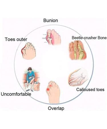 Bunion Corrector Beach Sandals - Women's Summer Strappy Flip Flops & Lightweight Orthopedic Slippers for Hallux Valgus - Buy Online on GoSupps.com