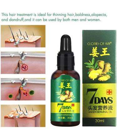 Ginger Germinal Oil Hair Growth Oil 2019 Hair Growth Serum Ginger Germinal Essential Oil Hair Loss Treatment Hair Care Hair Growth Serum Repairs Hair Follicles Promotes Thicker Hair Regrowth-30ml - Buy Online on GoSupps.com