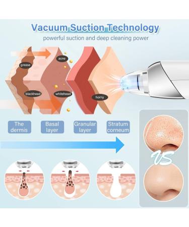 Rotatable Blackhead Remover Vacuum with 5 Probes - USB Rechargeable Pimple Extractor for Acne, Whiteheads, and Comedones - Powerful Pimple Popper Tool Kit for Men and Women - Buy Online on GoSupps.com