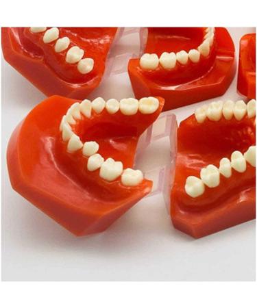 Teeth Educational Model - Orthodontic Classification & Lesson Model for Dental Training | International Shipping Available - Buy Online on GoSupps.com