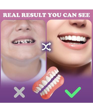 2 PCS Fake Teeth Veneers for Women and Men - Temporary Dental Veneers for Tooth Repair - Upper and Lower Jaw Protection - Bright White Smile - Buy Online on GoSupps.com