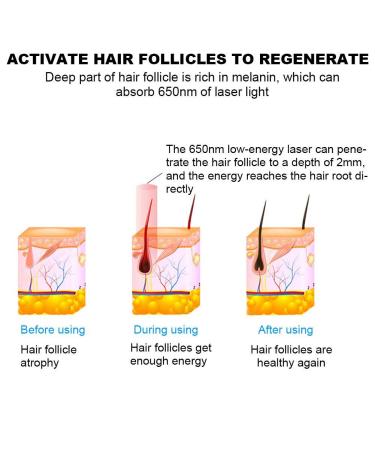 Laser Hair Growth Device - 180 Light Chips for Enhanced Hair Growth (Gray) | International Shipping Available - Buy Online on GoSupps.com