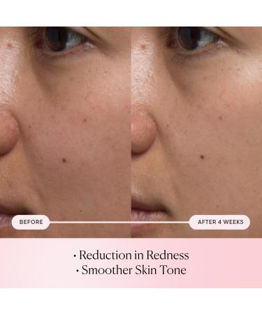 ELEMIS Pro-Collagen Rose Micro Serum | Ultimate Hydration for Plump Youthful Skin - Reduce Fine Lines & Wrinkles - International Shipping Available - Buy Online on GoSupps.com