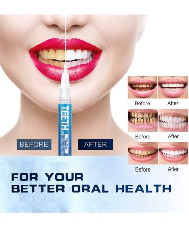 Teeth Whitening Pen - 4 Pack, 70 Treatments, No Sensitivity, Fast Results, Enamel Safe - Buy Online on GoSupps.com