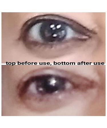 Advanced Anti-Aging Eye Treatment Serum for Rapid Reduction of Under-Eye Bags, Wrinkles, and Fine Lines - Brightening Formula with Niacinamide and Hyaluronic Acid - Buy Online on GoSupps.com