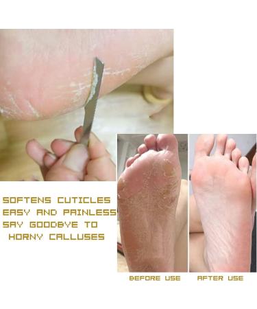 3PCS Stainless Steel Ingrown Toenail Pedicure Knife Set - Professional Foot Repair Tool Kit - Buy Online on GoSupps.com