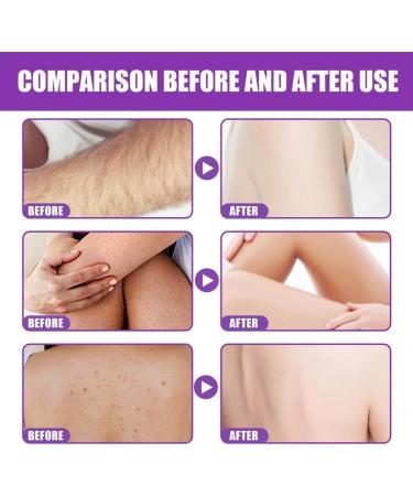 Brightening Body Scrub Skin Cleansing Gel Mud Scrub Anti-Wrinkle Anti-Cellulite Body Scrub for Women Exfoliates and Moisturizes Skin - Buy Online on GoSupps.com