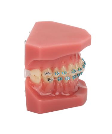 Typodont Orthodontic Tooth Model (28 Teeth) - Complete representation of crowded teeth malocclusion open jaw