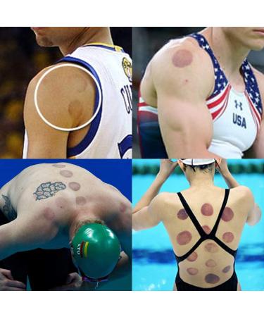 Cupping Set 24 Cups - Professional Chinese Acupoint Therapy for Pain Relief & Wellness - Buy Online on GoSupps.com