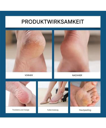  Jukeoiu Foot Care Cream - Nourishing Cream for Men and Women - Absorbs Quickly for Adults - Buy Online on GoSupps.com