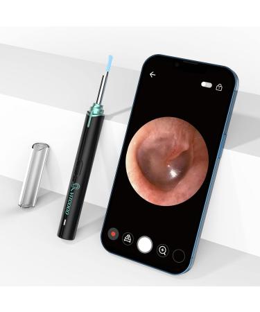 VITCOCO Otoscope 8-Piece Silicone Ear Spoon Set for Ear Wax Removal | Reusable & Camera Compatible | Home Ear Health Care Accessories - Buy Online on GoSupps.com