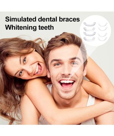 Frenzy 1 Couples Cosmetic Tooth Veneers | Instant Perfect Smile & Comfort Fit Flex Dental Covers for Bad Teeth - Buy Online on GoSupps.com