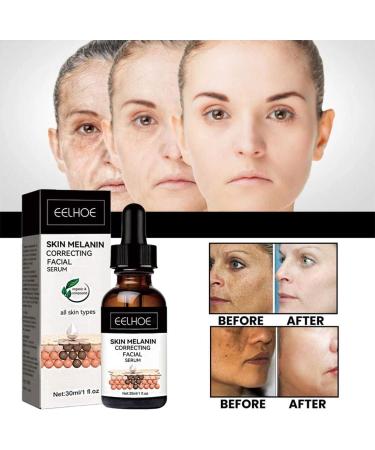 Melanin Correcting Face Serum Dark Spot Correcting Serum Moisturizing Repairing Face Serum Hydrate Anti-Wrinkle Facial Essence Collagen Face Serum Firms and Rejuvenates Skin - Buy Online on GoSupps.com