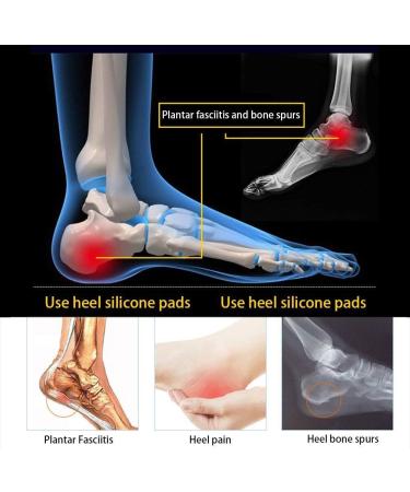 Best Heel Cushion Cups for Plantar Fasciitis | Pain Relief Insoles - International Shipping - Buy Online on GoSupps.com
