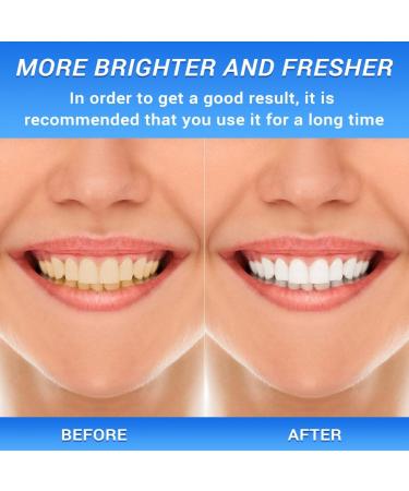 BodyAccel Nicotinamide Dazzle White Toothpaste - Fresh Breath Sensitive Teeth Repair Cavity Prevention Antiplaque Natural Peppermint - International Shipping Available - Buy Online on GoSupps.com