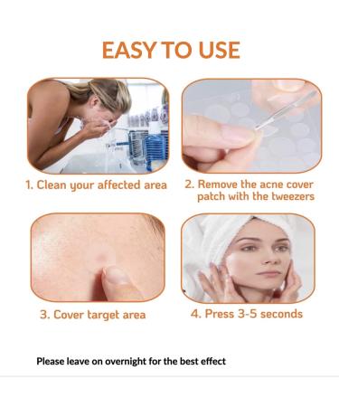 Pimple Patches 180 Count with Tweezers - Hydrocolloid Acne Cover Patch for Quick Healing - Spot Stickers for Face and Skin - Buy Online on GoSupps.com