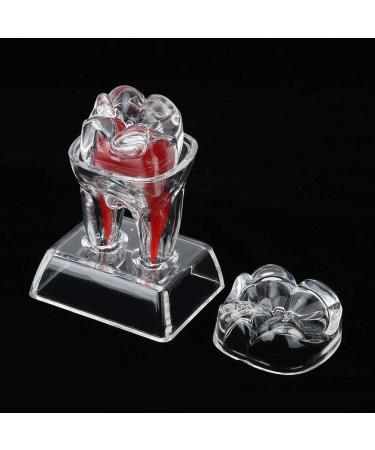 Discriminable Toothed Tooth Model for Endodontics | Plastic Teeth Teaching Material for Dental Studies & Research | International Shipping Available - Buy Online on GoSupps.com