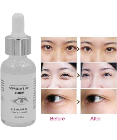 Tightening Eye Contour Serum - Revitalizing Eye Contour Reduce Dark Circles Eye Bags and Wrinkles Serums and Fluids - Buy Online on GoSupps.com