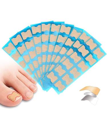 Ingrown Toenail Correction Patch - Paronychia Corrector Treatment - Glue-free Toe Nail File - 4 Sizes - Foot Care Pedicure Tool - Buy Online on GoSupps.com