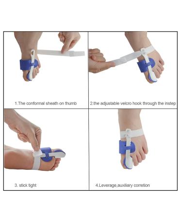 Genetic Hallux Valgus Corrector | Adjustable Bunion Correction | Orthopedic Foot Care for Men & Women - White/Blue - Buy Online on GoSupps.com