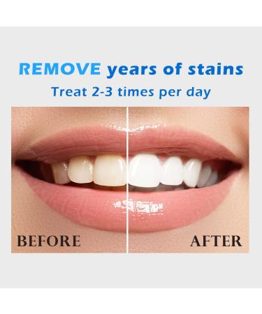 Venus Visage Teeth Whitening Pen - 4 Pens, 40+ Uses, Painless & Travel-Friendly - Natural Mint Flavor - Buy Online on GoSupps.com