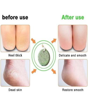 2 Packs Natural Pumice Stone Natural Lava Scrubber Foot Scrubber Pumice Stone for Removing Dead Skin/Hard Skin Foot File for Skin Exfoliation - Buy Online on GoSupps.com